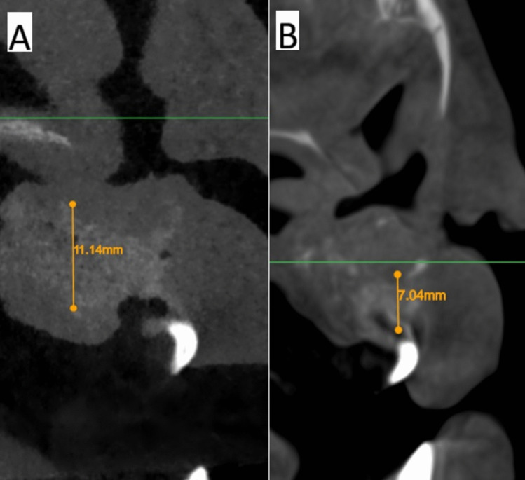 Figure 10