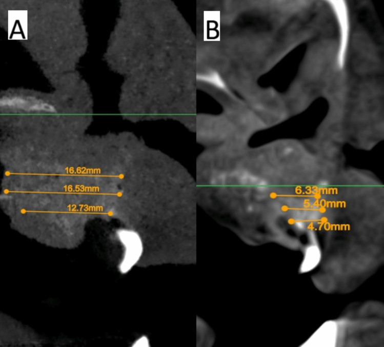 Figure 9