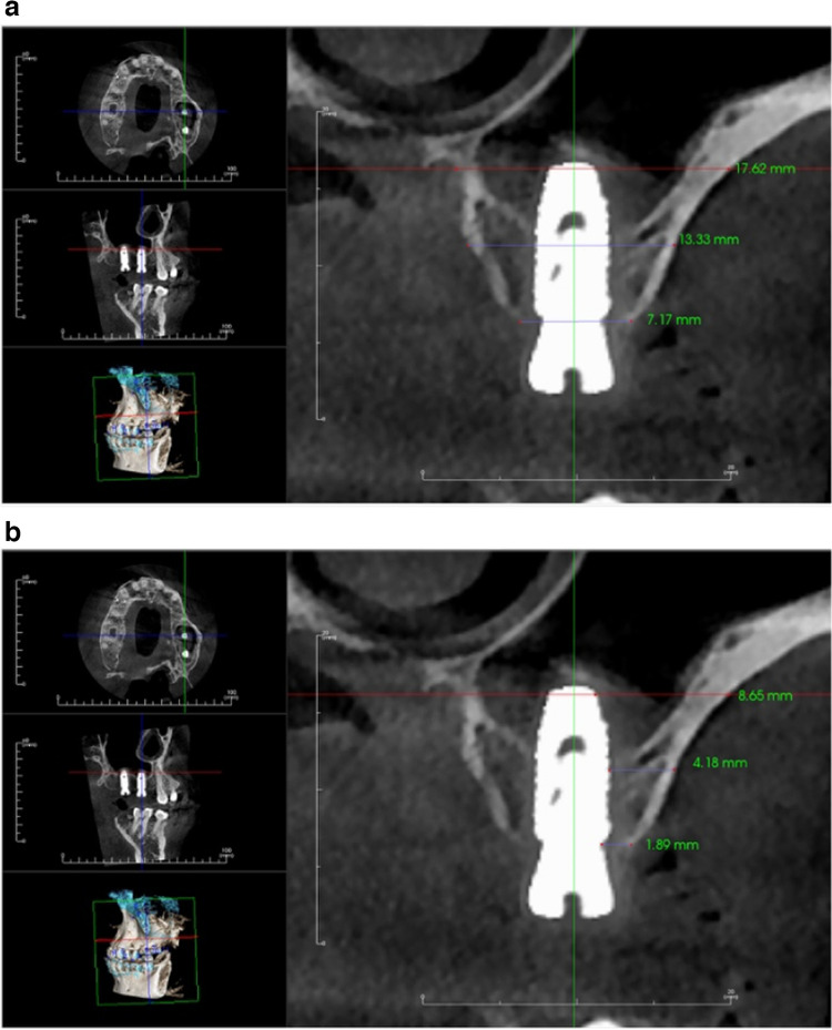 Figure 12