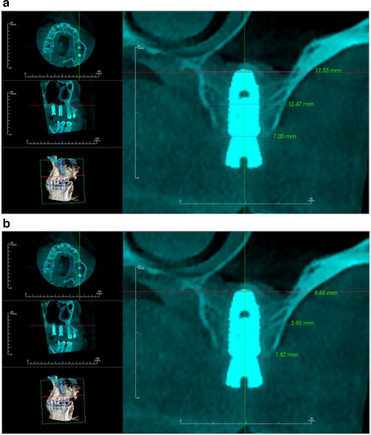 Figure 13
