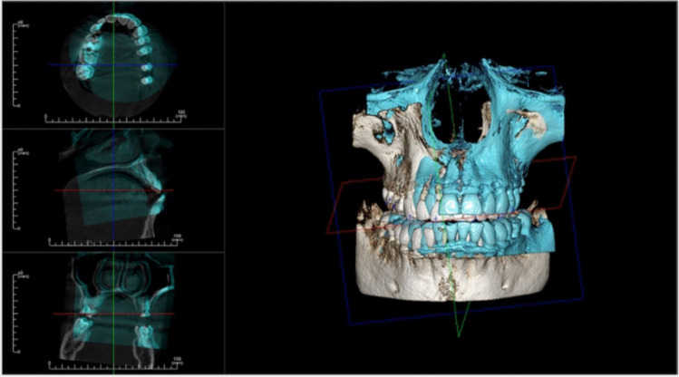 Figure 14