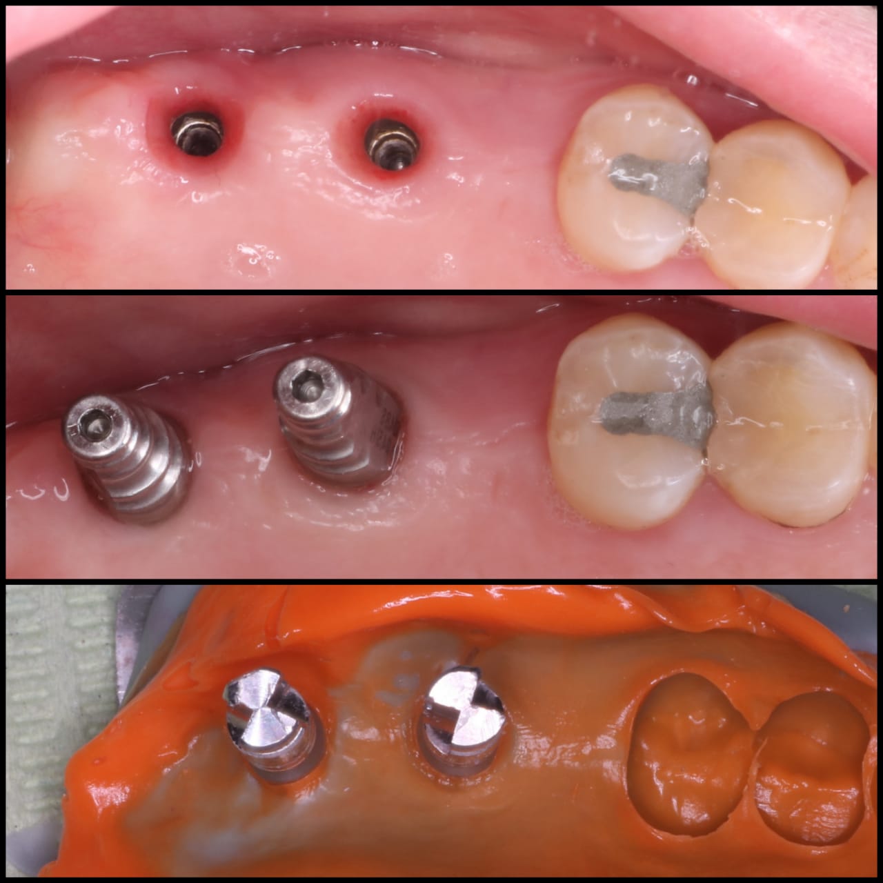 Figure 18