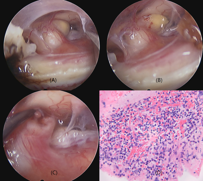 Figure 2