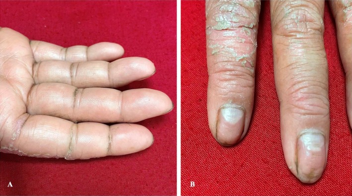 FIGURE 3