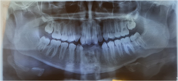 FIGURE 3