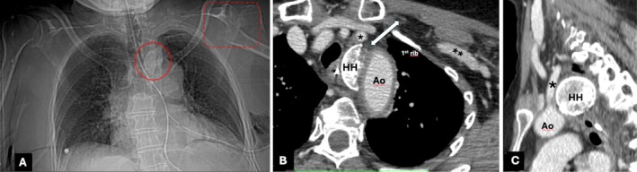 FIGURE 1