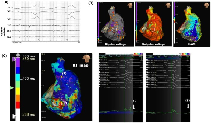 FIGURE 3