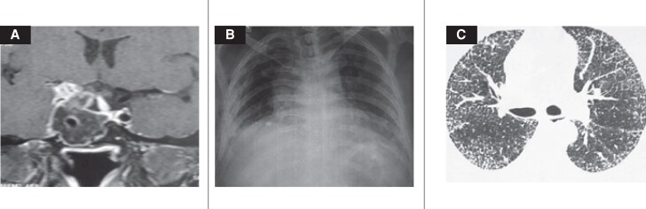 Figure 2