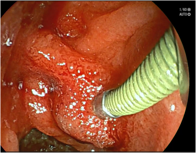 Figure 5