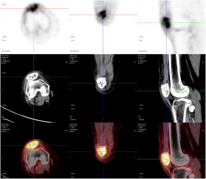 Figure 3