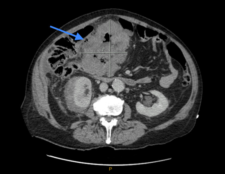 Figure 9