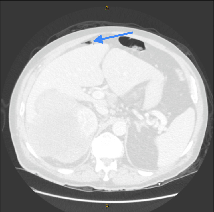 Figure 10