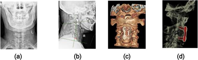 Figure 4