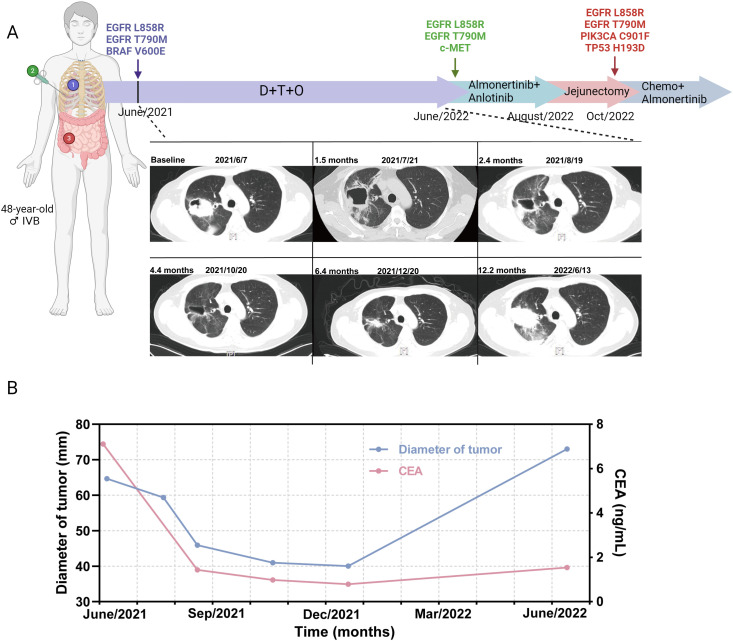 Figure 4