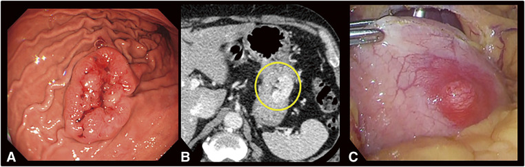 Fig. 1