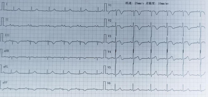FIGURE 1
