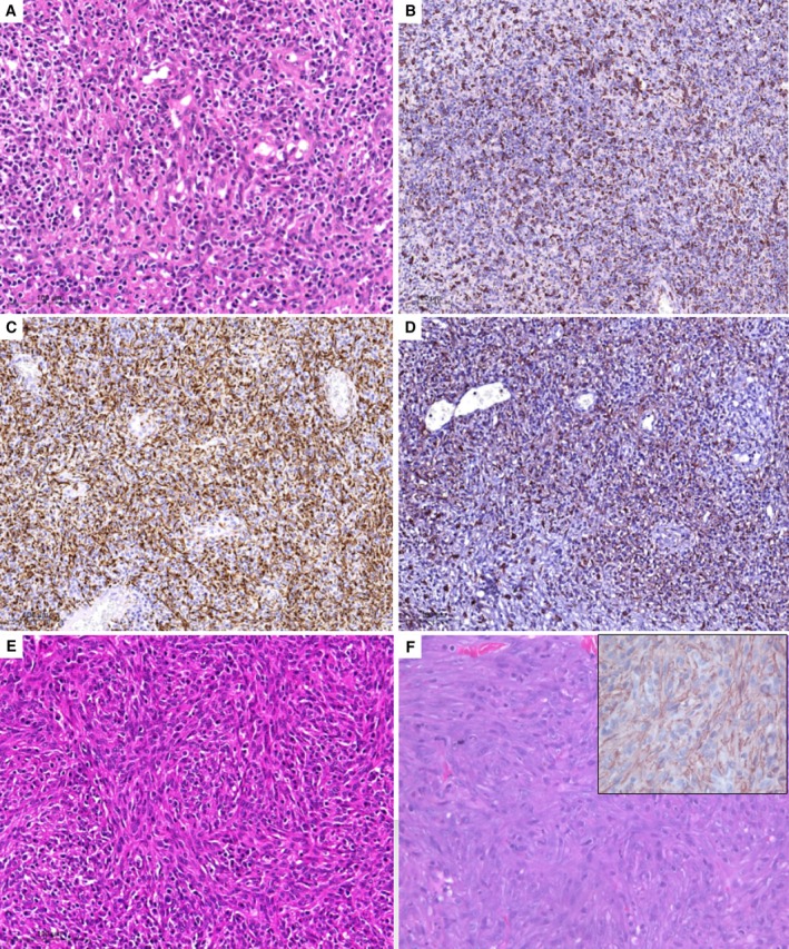FIG 4