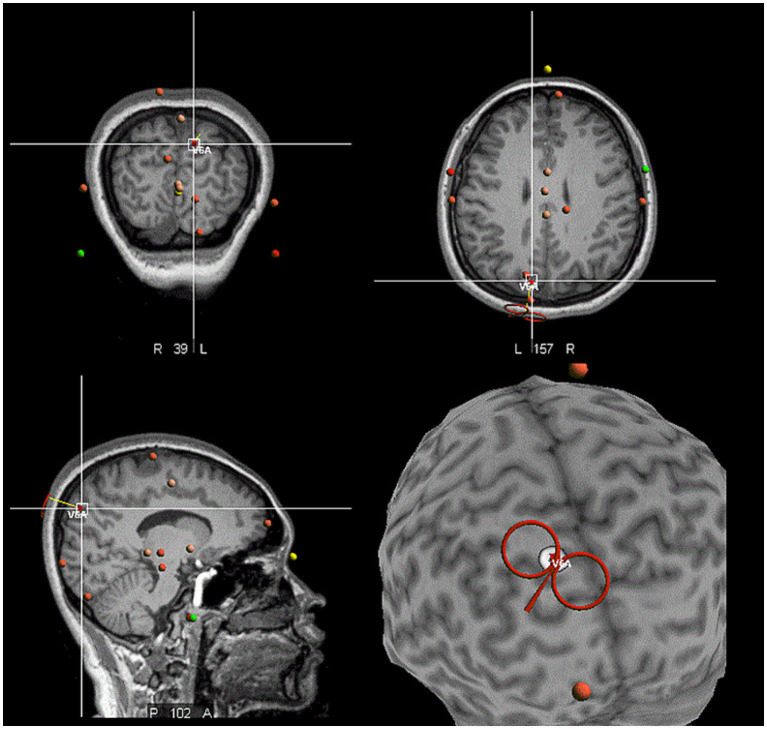 Figure 2