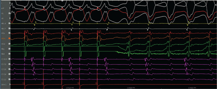 Figure 5
