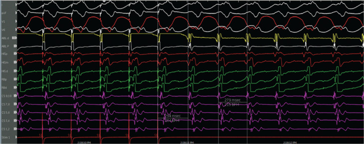 Figure 9