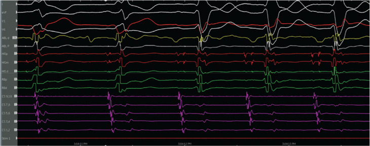 Figure 11
