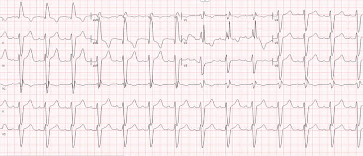 Figure 12