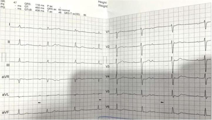 Figure 6