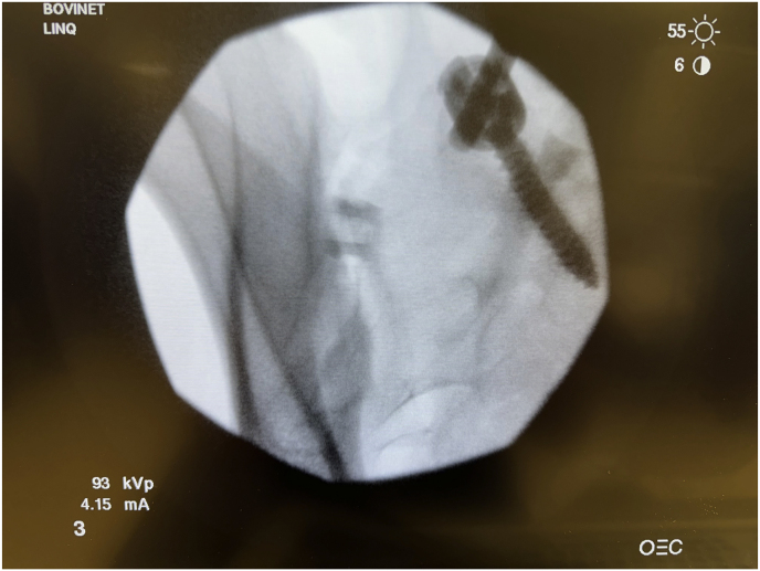 Figure 2