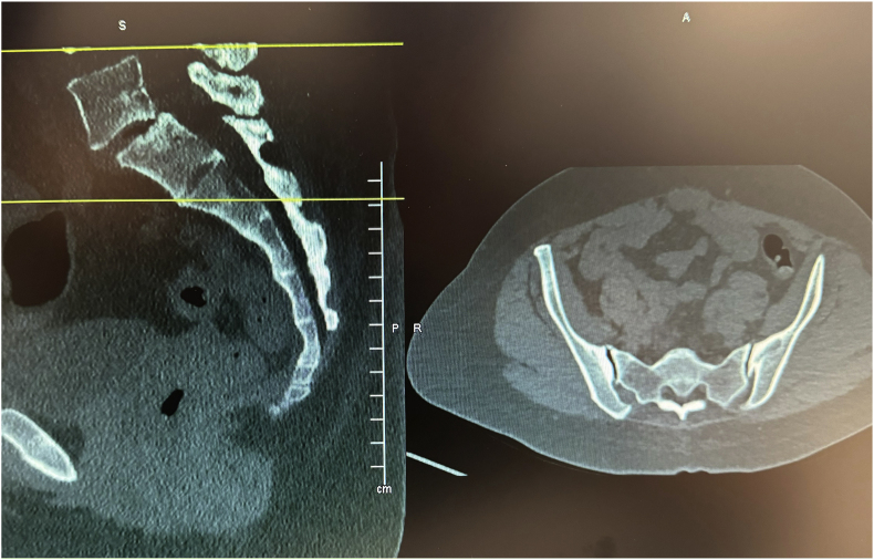 Figure 9