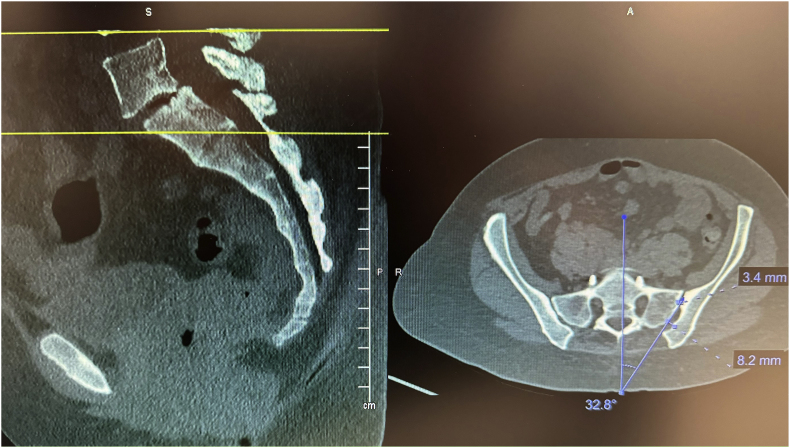 Figure 11