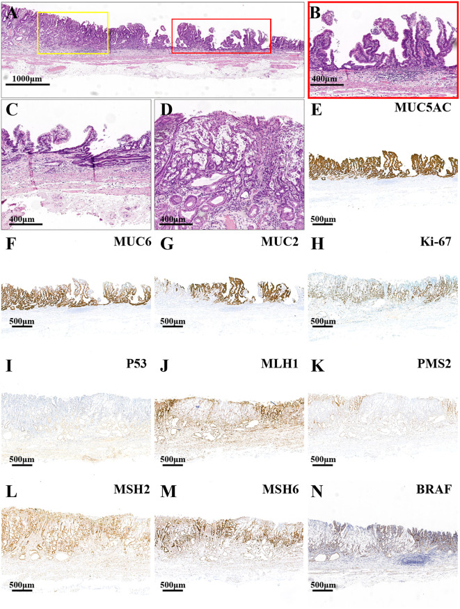 Figure 2