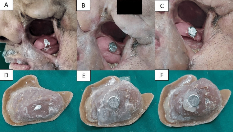 Figure 6