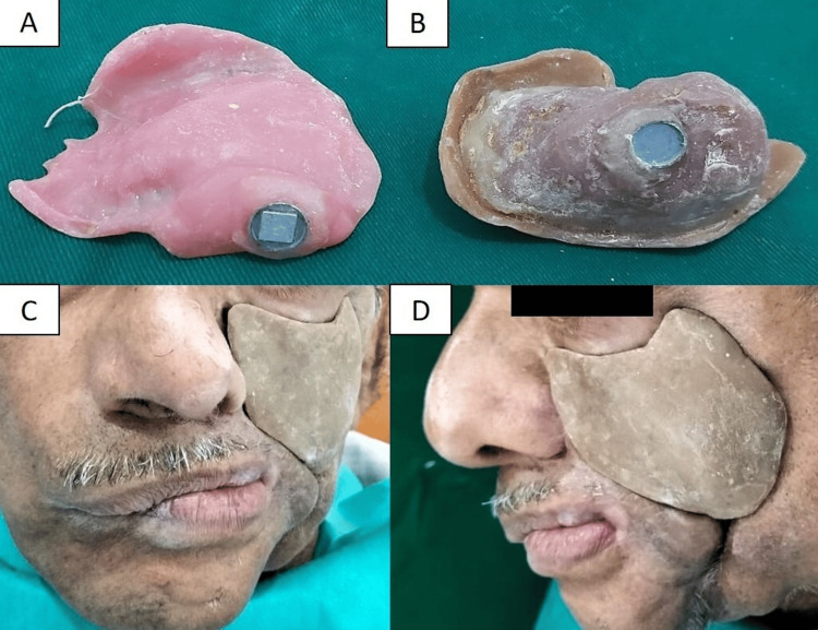 Figure 7