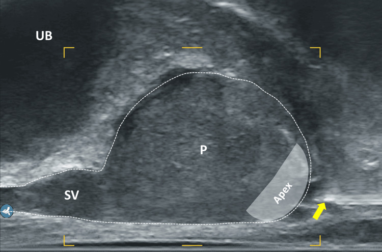 Figure 9