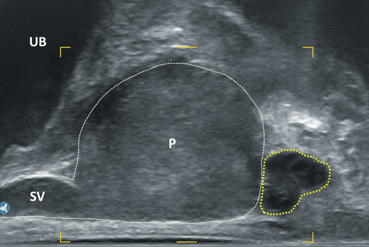 Figure 10