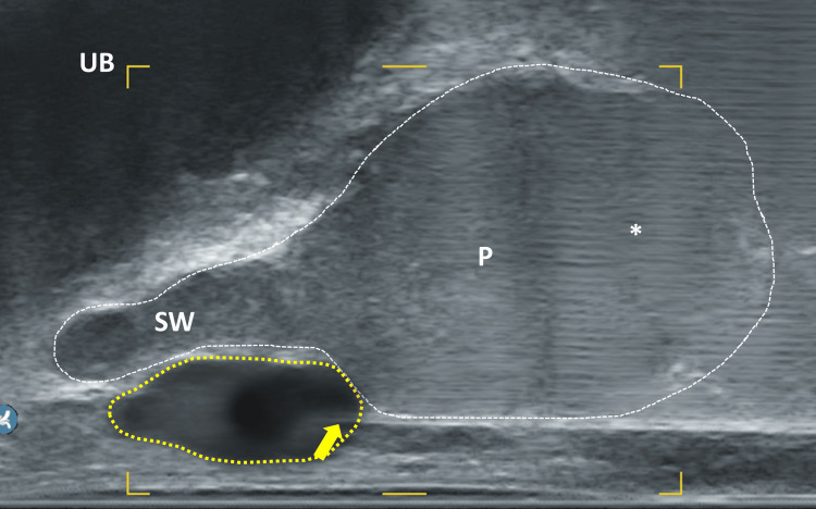 Figure 12