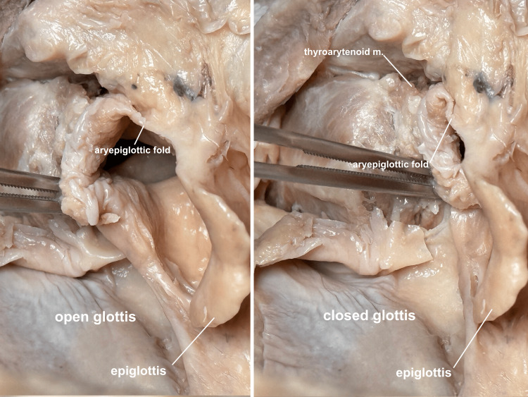 Figure 13