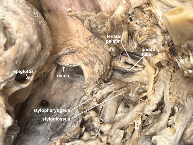 Figure 14