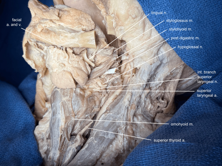 Figure 15