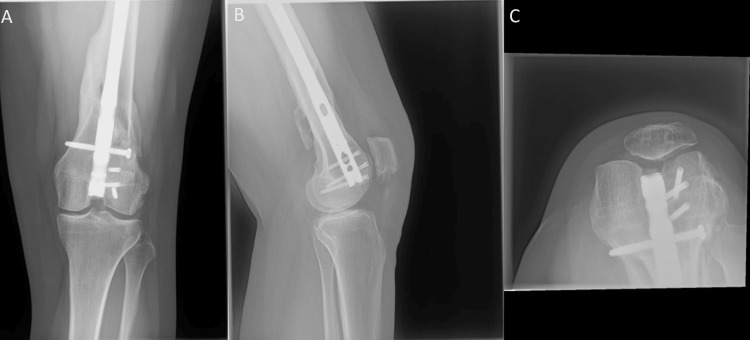 Figure 9