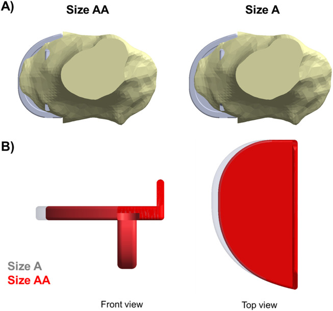 FIGURE 14