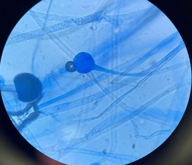 Figure 9