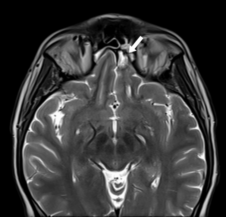 Figure 13