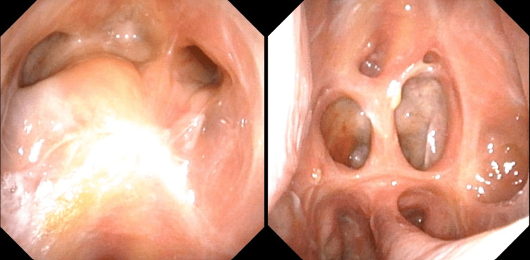 Figure 14