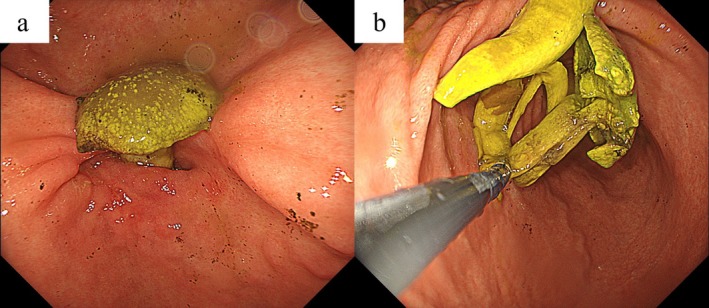 FIGURE 2