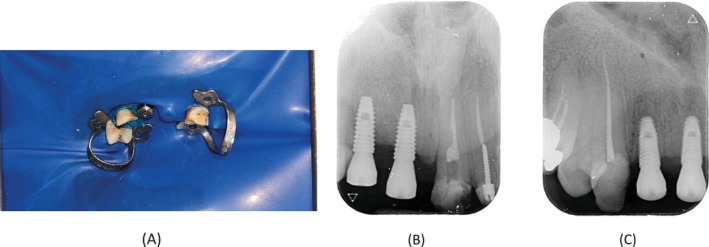 FIGURE 4