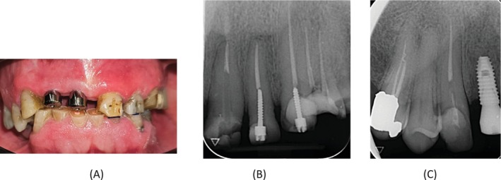 FIGURE 1