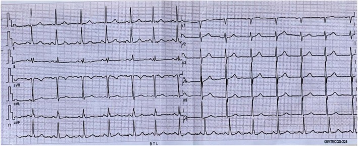FIGURE 1