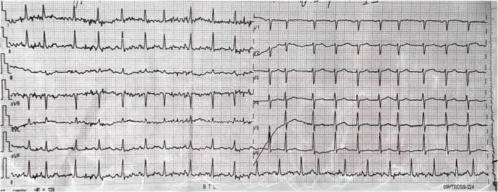 FIGURE 2
