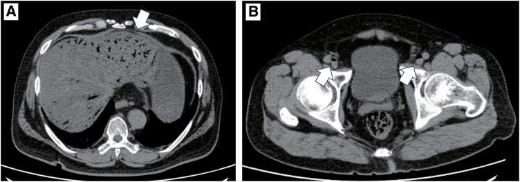 Fig. 1